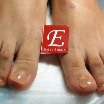 Лечение грибка в студии «E-Studio» в Харькове. Записаться со скидкой