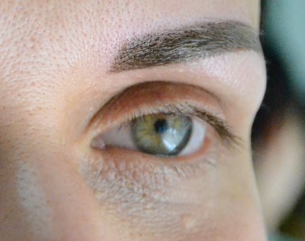 Botulinum eye therapy in the cosmetology studio of Anna Kolesnik in Kharkov. Sign up for the promotion.